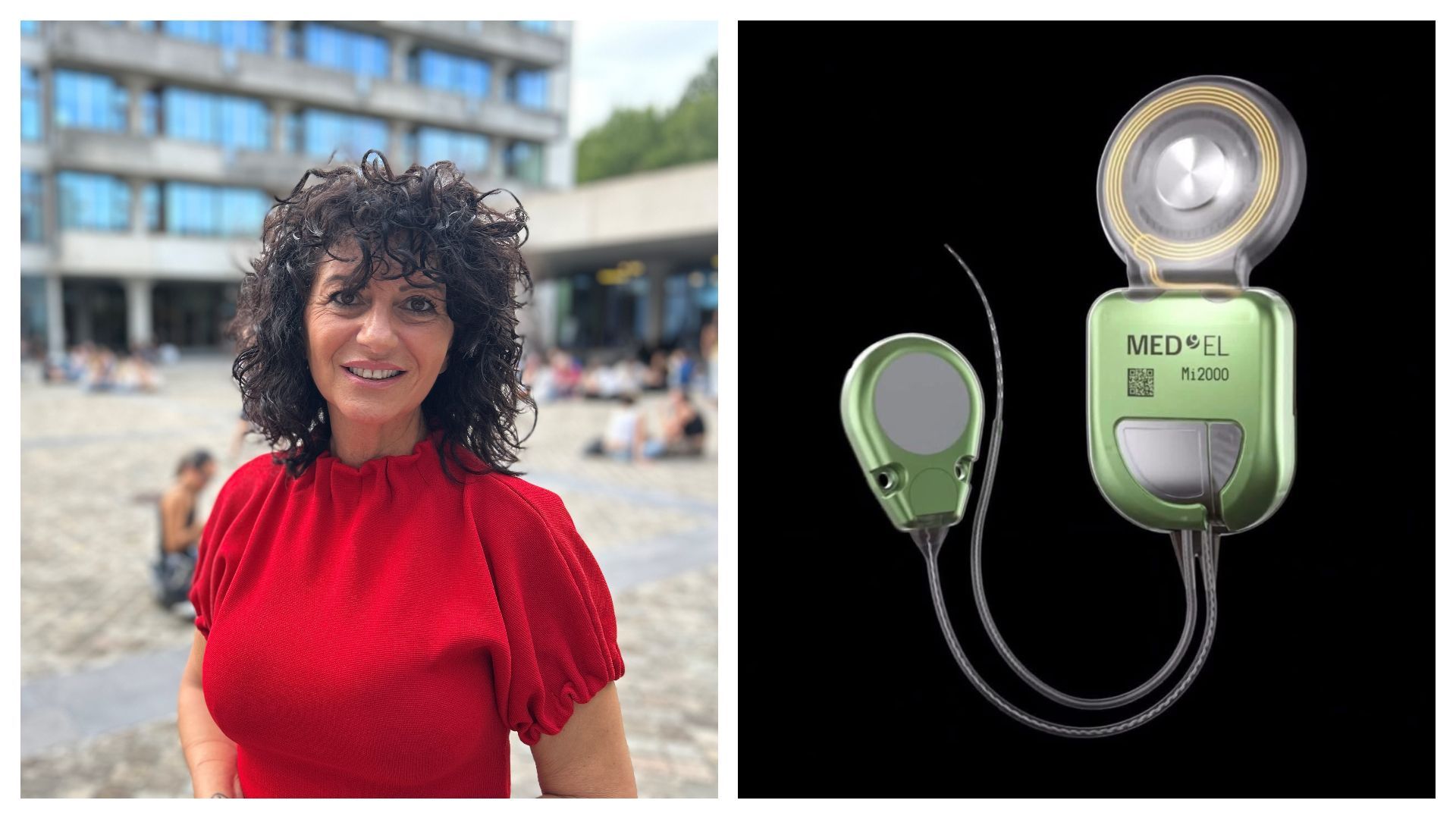 Angela retrouve l'audition complète grâce à un implant invisible, transformant son quotidien