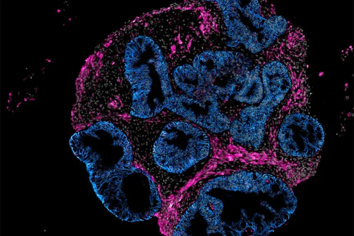 Intero Biosystems plaide pour des tests de médicaments sur des modèles intestinaux humains plutôt que sur des animaux