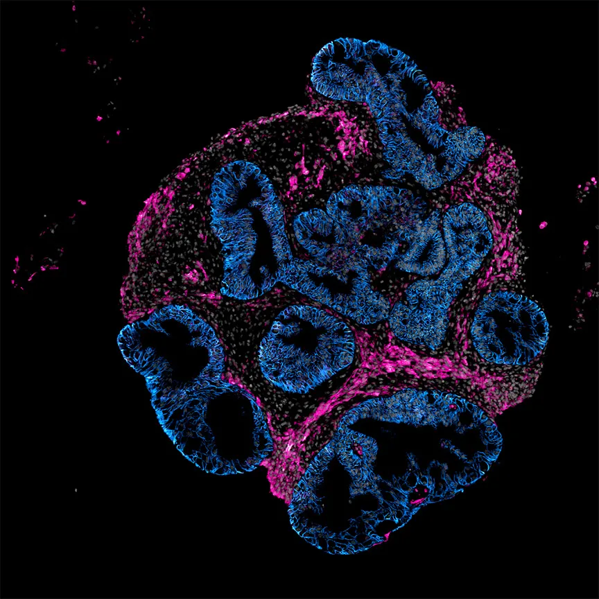 Intero Biosystems plaide pour des tests de médicaments sur des modèles intestinaux humains plutôt que sur des animaux
